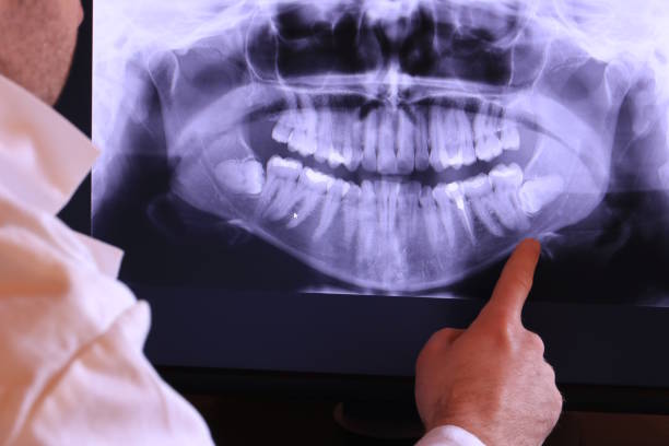 Best Cosmetic Emergency Dentistry in La Harpe, IL