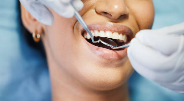 Best Emergency Tooth Extraction in La Harpe, IL