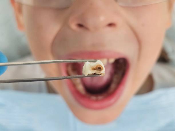 Best Emergency Gum Treatment in La Harpe, IL
